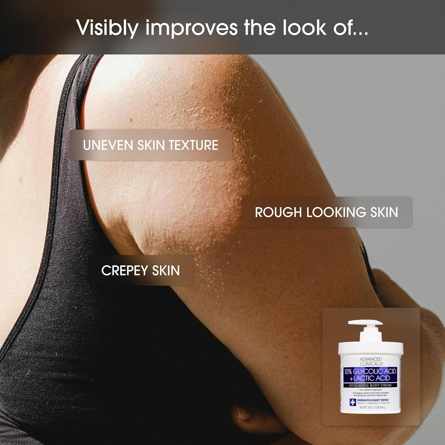 image:imageAdvanced Clinicals Brightening Vitamin C Body Cream AHA Exfoliating 10 Glycolic Acid amp Lactic Acid Lotion 2PC Skincare Set For Women amp Men To Reduce Appearance Of Dark Spots amp Uneven Skin Tone10 Glycolic Acid Vitamin C Cream Set