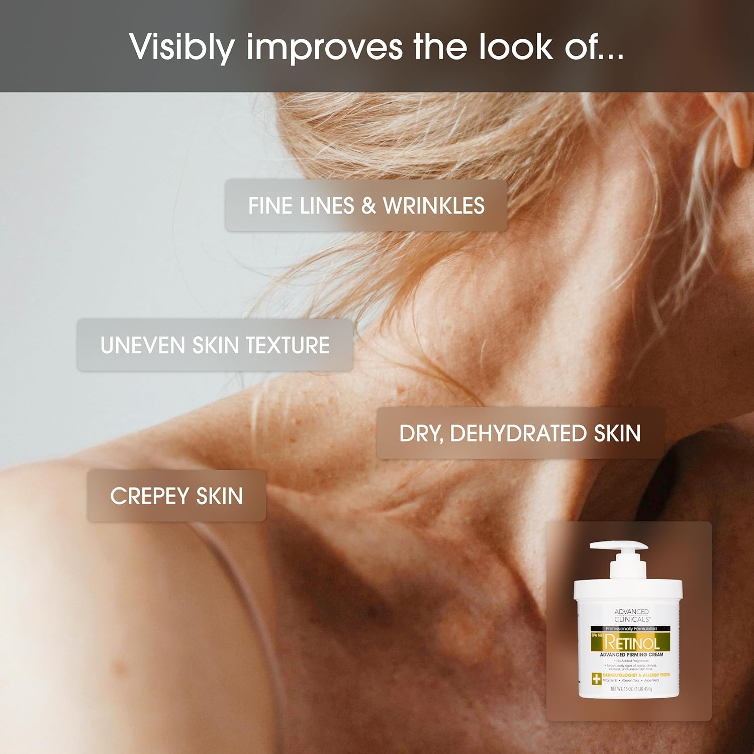 image:imageAdvanced Clinicals Retinol Body Lotion amp Face Moisturizer Anti Aging Skin Care Retinol Body Cream For Women amp Men Improves Appearance Of Fine Lines Wrinkles amp Look Of Crepey Skin WTravel SizeRetinol Cream