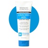 Cracked Heel Foot Lotion